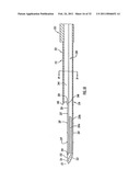 Instruments and Methods for Minimally Invasive Carpal Tunnel Release diagram and image