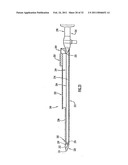 Instruments and Methods for Minimally Invasive Carpal Tunnel Release diagram and image