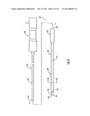 Instruments and Methods for Minimally Invasive Carpal Tunnel Release diagram and image