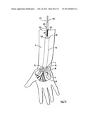 Instruments and Methods for Minimally Invasive Carpal Tunnel Release diagram and image