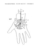 Instruments and Methods for Minimally Invasive Carpal Tunnel Release diagram and image