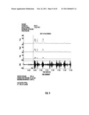 ORAL-ESOPHAGEAL-GASTRIC DEVICE WITH ESOPHAGEAL CUFF TO REDUCE GASTRIC REFLUX AND/OR EMESIS diagram and image