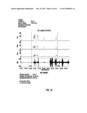 ORAL-ESOPHAGEAL-GASTRIC DEVICE WITH ESOPHAGEAL CUFF TO REDUCE GASTRIC REFLUX AND/OR EMESIS diagram and image