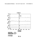 ORAL-ESOPHAGEAL-GASTRIC DEVICE WITH ESOPHAGEAL CUFF TO REDUCE GASTRIC REFLUX AND/OR EMESIS diagram and image