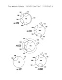 ORAL-ESOPHAGEAL-GASTRIC DEVICE WITH ESOPHAGEAL CUFF TO REDUCE GASTRIC REFLUX AND/OR EMESIS diagram and image