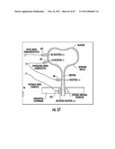 ORAL-ESOPHAGEAL-GASTRIC DEVICE WITH ESOPHAGEAL CUFF TO REDUCE GASTRIC REFLUX AND/OR EMESIS diagram and image