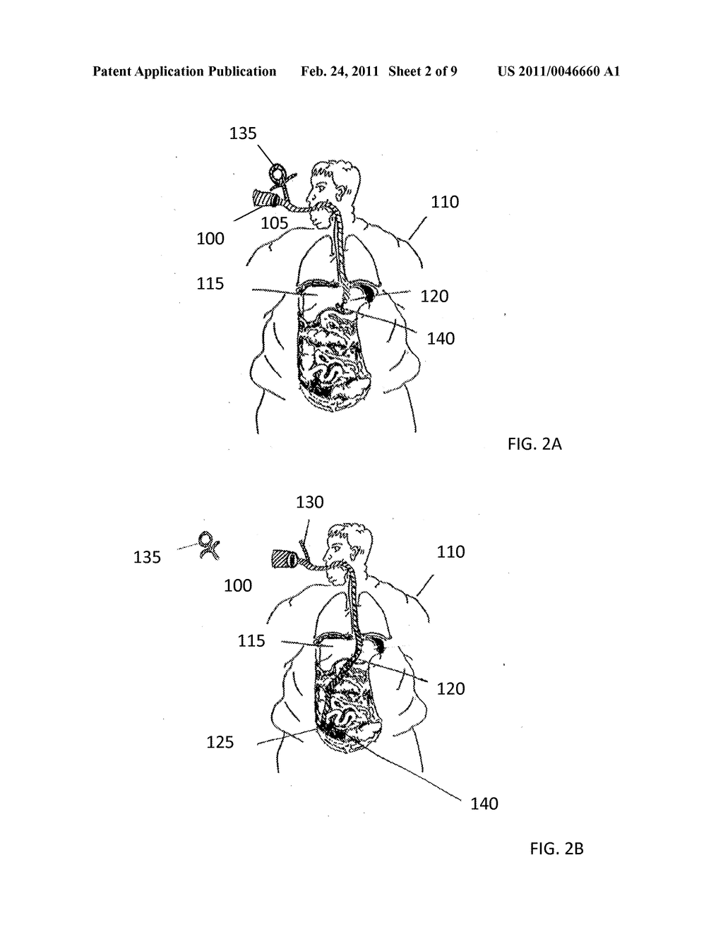 Endoscopic Forceps With Removable Handle - diagram, schematic, and image 03