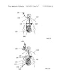 Endoscopic Forceps With Removable Handle diagram and image