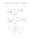 Endoscopic Forceps With Removable Handle diagram and image