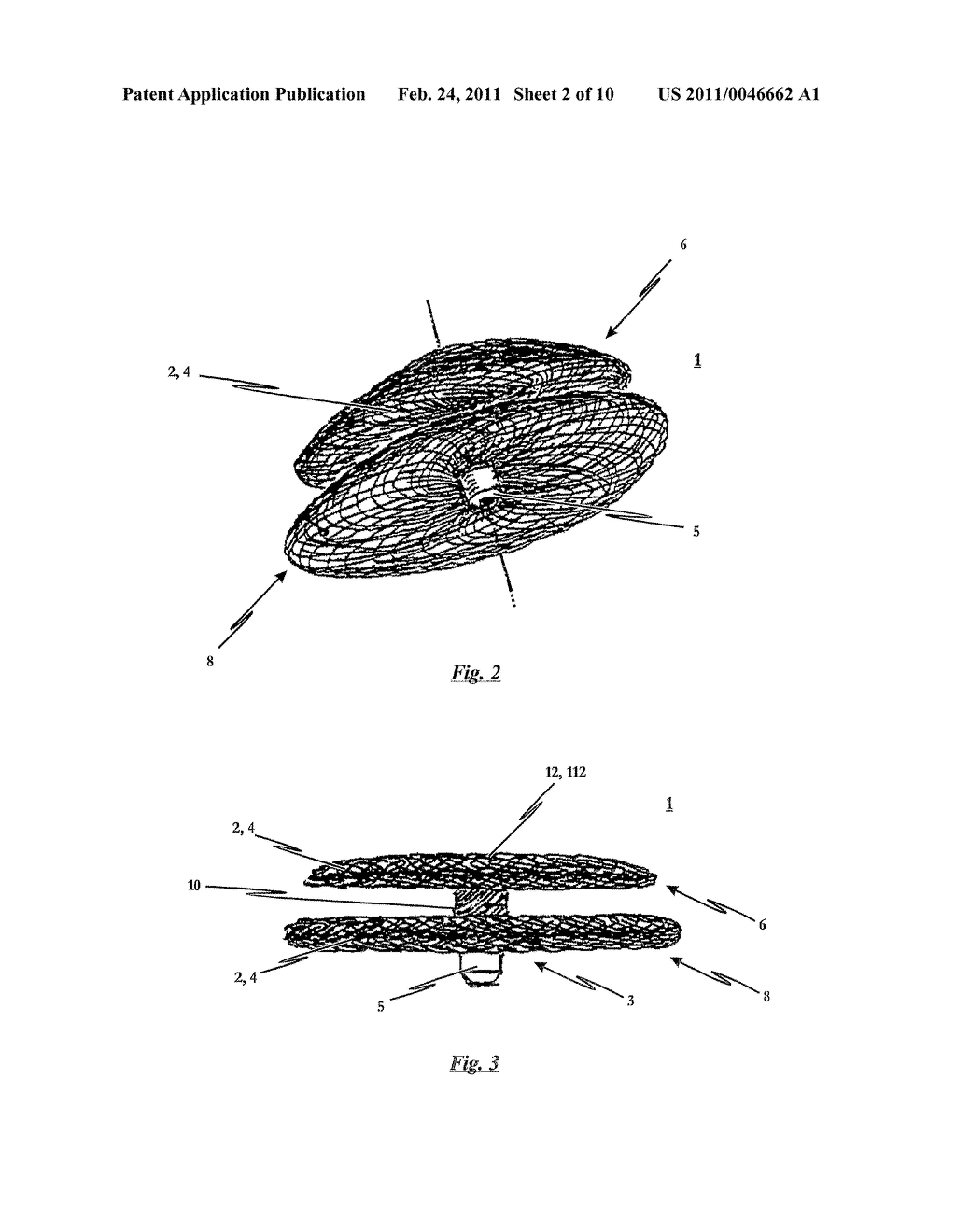 Occlusion Device And Method For Its Manufacture - diagram, schematic, and image 03