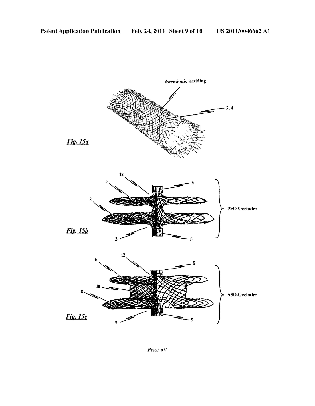 Occlusion Device And Method For Its Manufacture - diagram, schematic, and image 10