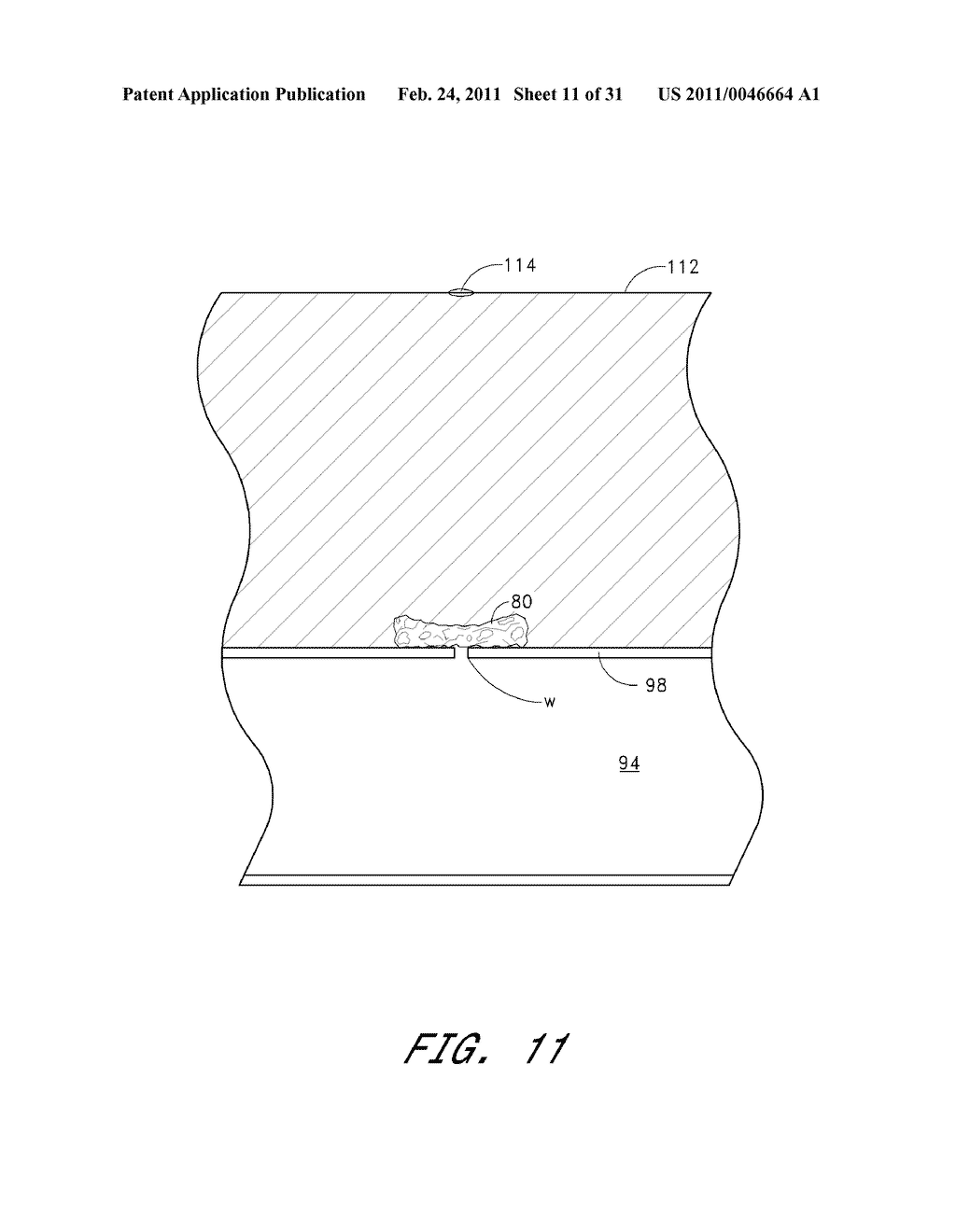 VASCULAR WOUND CLOSURE DEVICE AND METHOD - diagram, schematic, and image 12