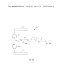 METHOD AND APPARATUS FOR ELEVATING RETAINERS ON SELF-RETAINING SUTURES diagram and image