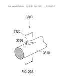 METHOD AND APPARATUS FOR ELEVATING RETAINERS ON SELF-RETAINING SUTURES diagram and image