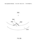 METHOD AND APPARATUS FOR ELEVATING RETAINERS ON SELF-RETAINING SUTURES diagram and image