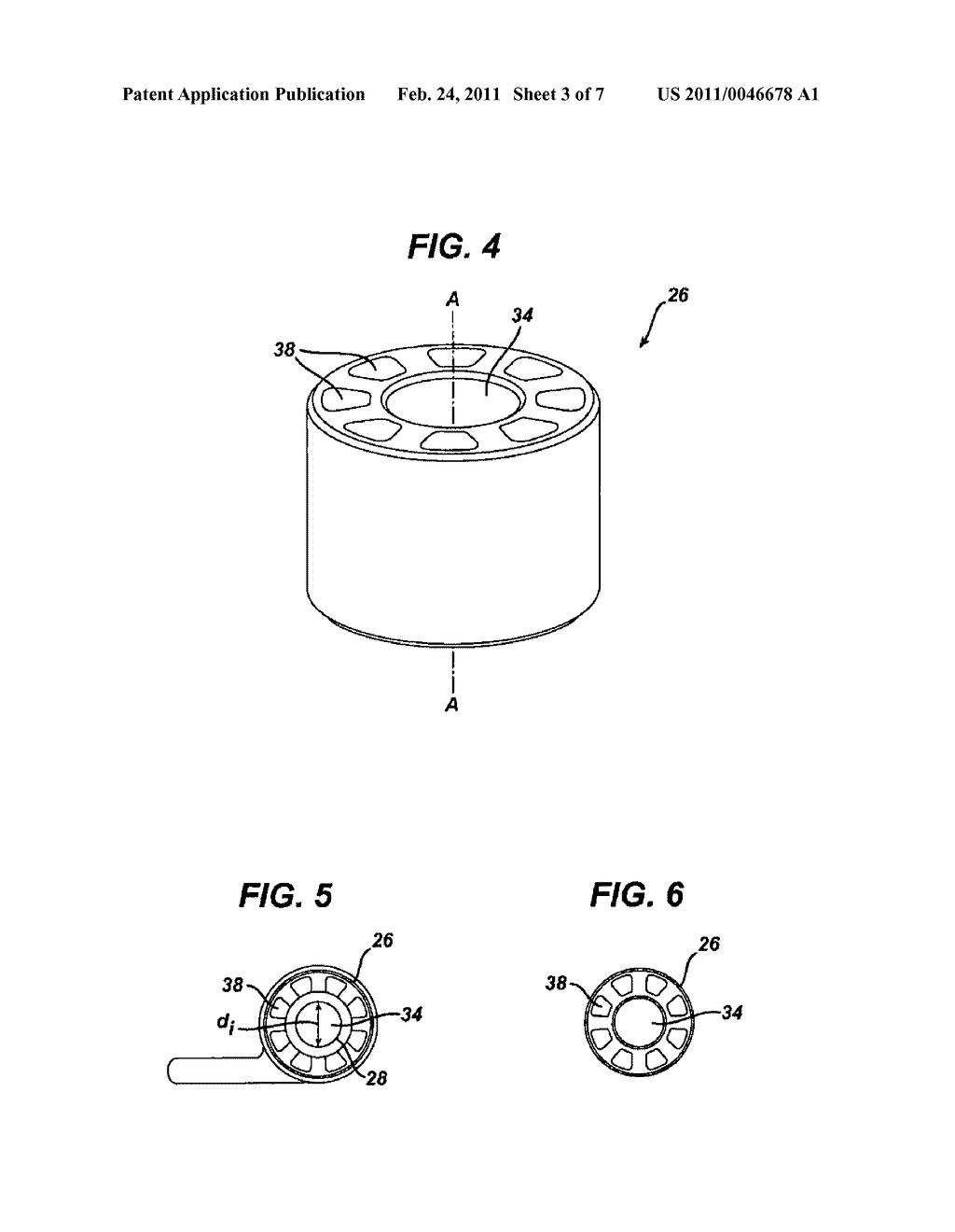 Facet Joint Prosthesis - diagram, schematic, and image 04