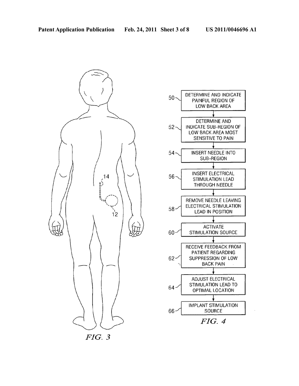 METHOD FOR NEUROLOGICAL STIMULATION OF PERIPHERAL NERVES TO TREAT PAIN - diagram, schematic, and image 04