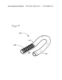 ATRAUMATIC VASCULAR GRAFT REMOVAL SHEATH diagram and image