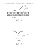 Biodegradable Metal-Polymer Composite Constructs For Implantable Medical Devices diagram and image