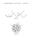 Biodegradable Metal-Polymer Composite Constructs For Implantable Medical Devices diagram and image