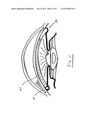 INTRAOCULAR PRESSURE REGULATING DEVICE diagram and image