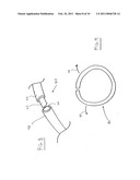 INTRAOCULAR PRESSURE REGULATING DEVICE diagram and image