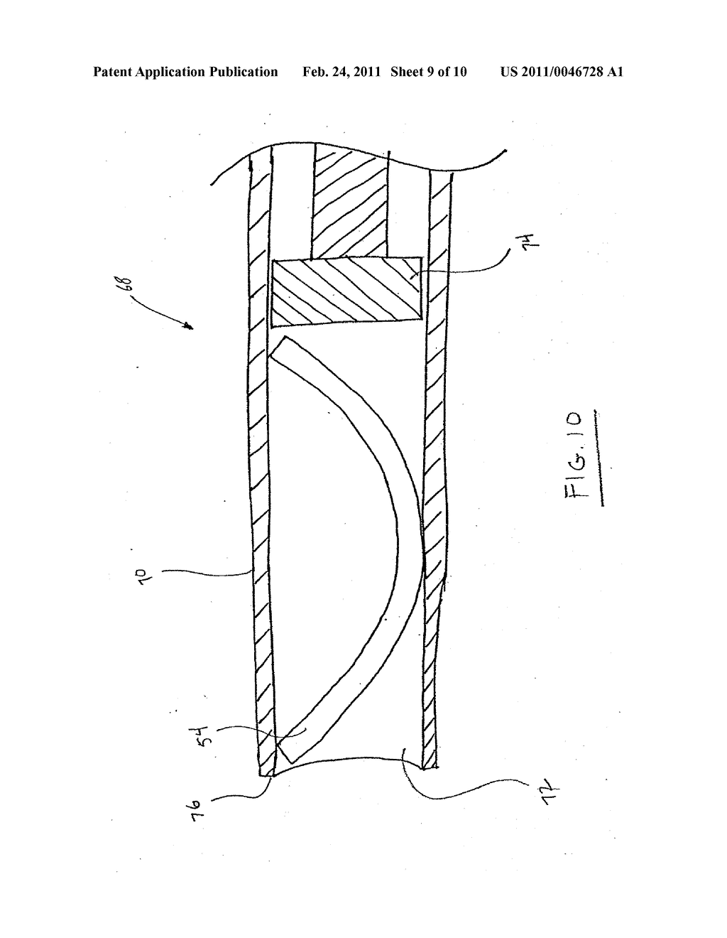 INTRAOCULAR PRESSURE REGULATING DEVICE - diagram, schematic, and image 10