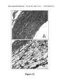 STRUCTURALLY MODIFIED ACELLULAR TISSUE ENGINEERING SCAFFOLDS AND METHODS OF PRODUCTION diagram and image