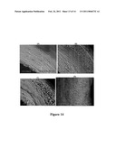 STRUCTURALLY MODIFIED ACELLULAR TISSUE ENGINEERING SCAFFOLDS AND METHODS OF PRODUCTION diagram and image