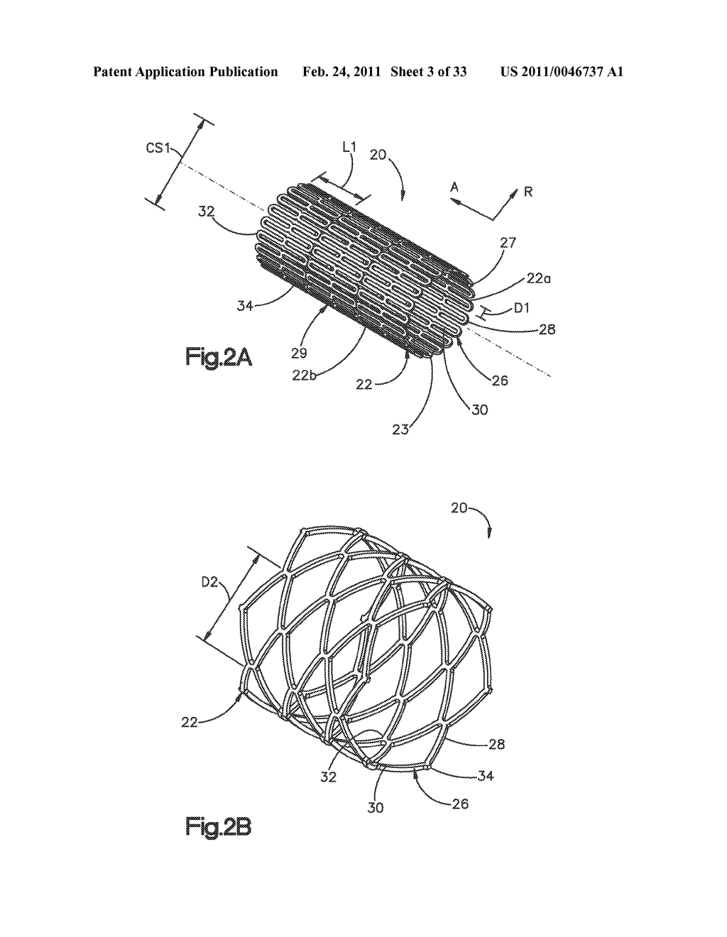 METHOD AND APPARATUS FOR AUGMENTING BONE - diagram, schematic, and image 04