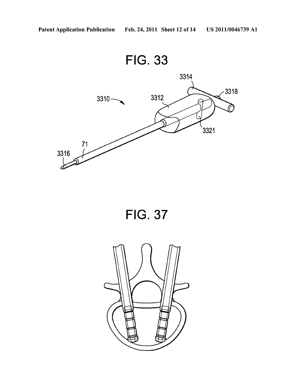 Methods and Apparatuses for Bone Restoration - diagram, schematic, and image 13