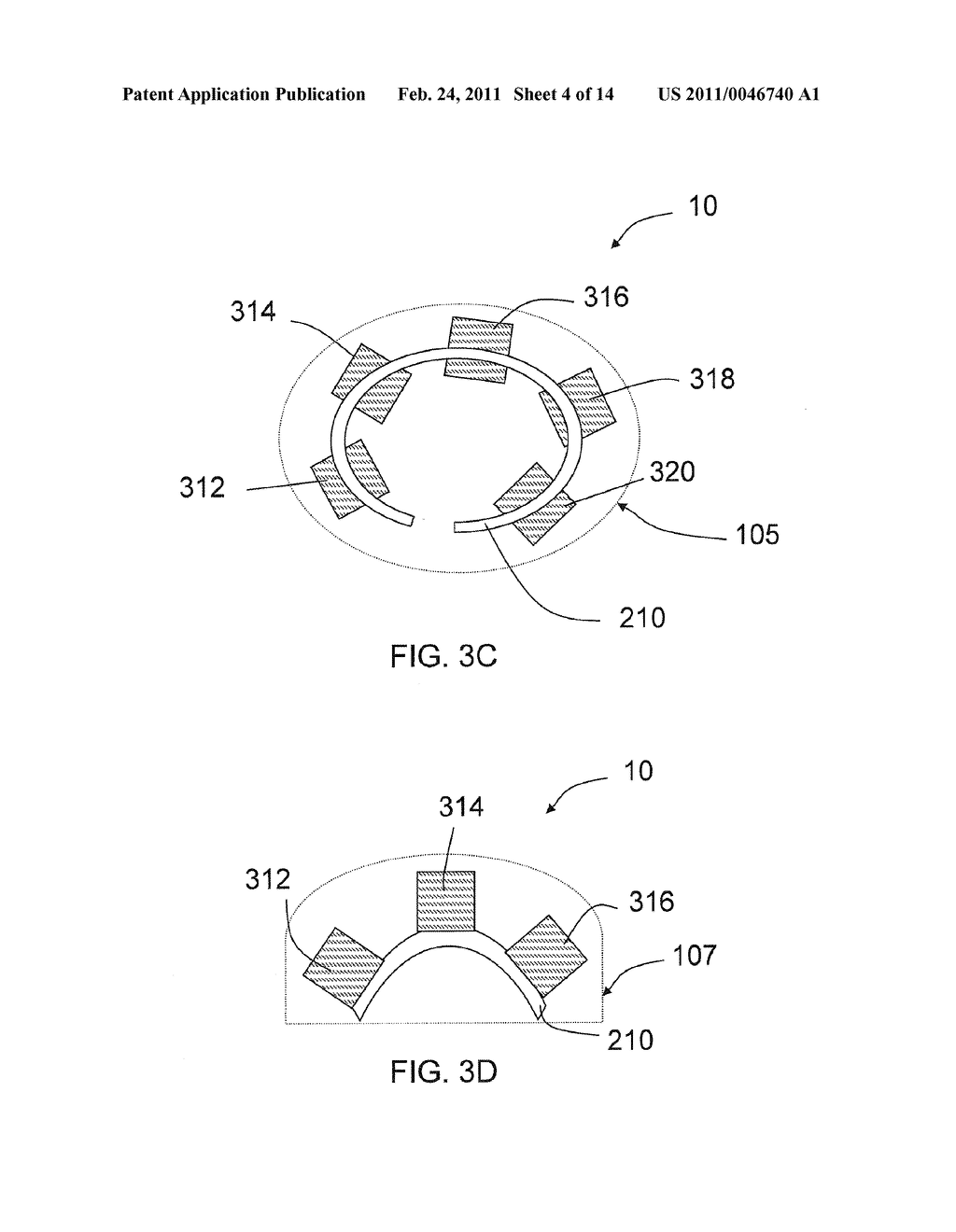 SPINAL IMPLANTS, SURGICAL INSTRUMENT SETS AND METHODS OF USING THE SAME - diagram, schematic, and image 05