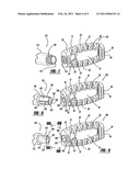 Minimally Invasive Interbody Device diagram and image