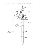 INSTRUMENT AND ASSOCIATED METHOD OF TRIALING FOR MODULAR HIP STEMS diagram and image