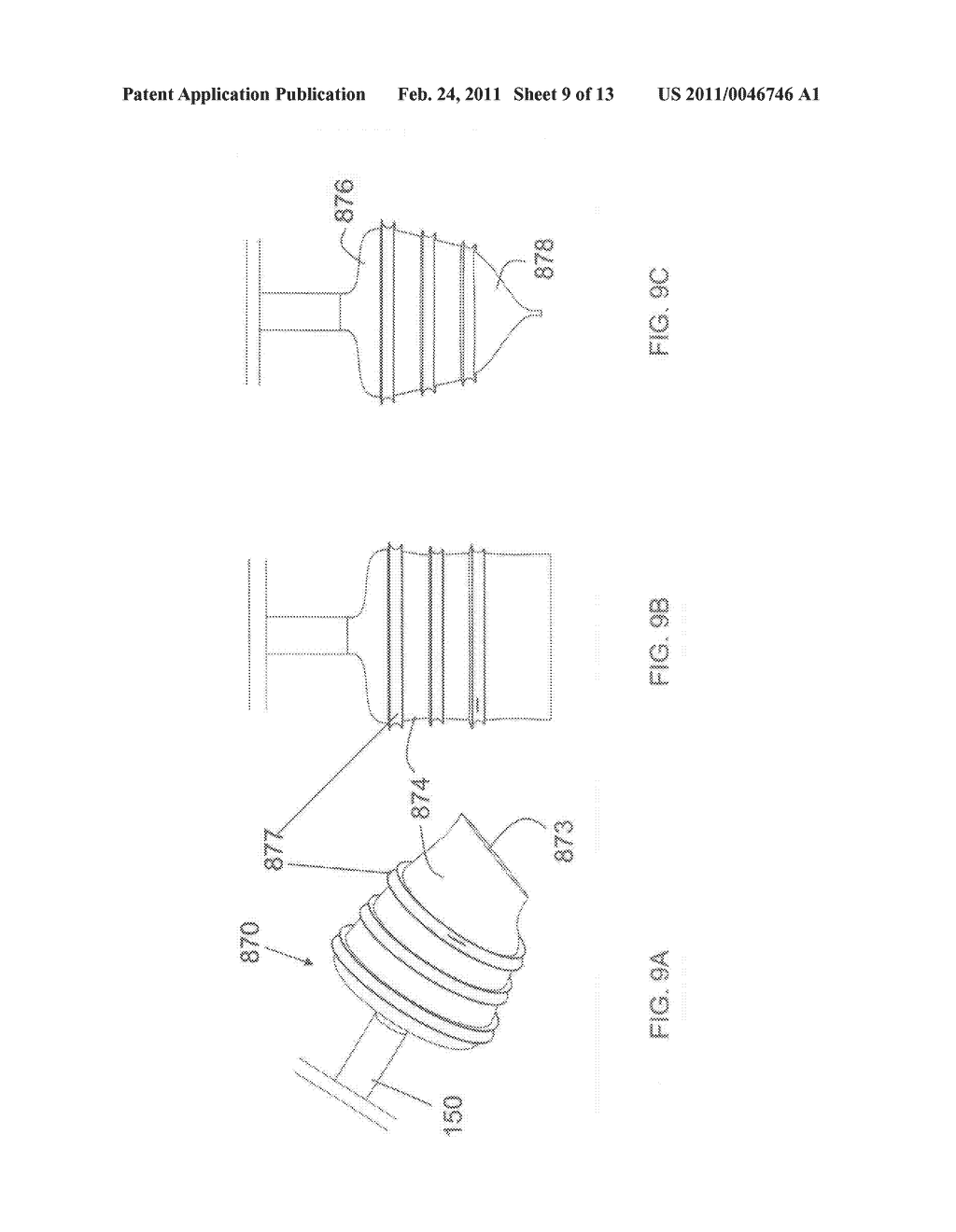 DEVICES AND METHODS FOR BONE ALIGNMENT, STABILIZATION AND DISTRACTION - diagram, schematic, and image 10