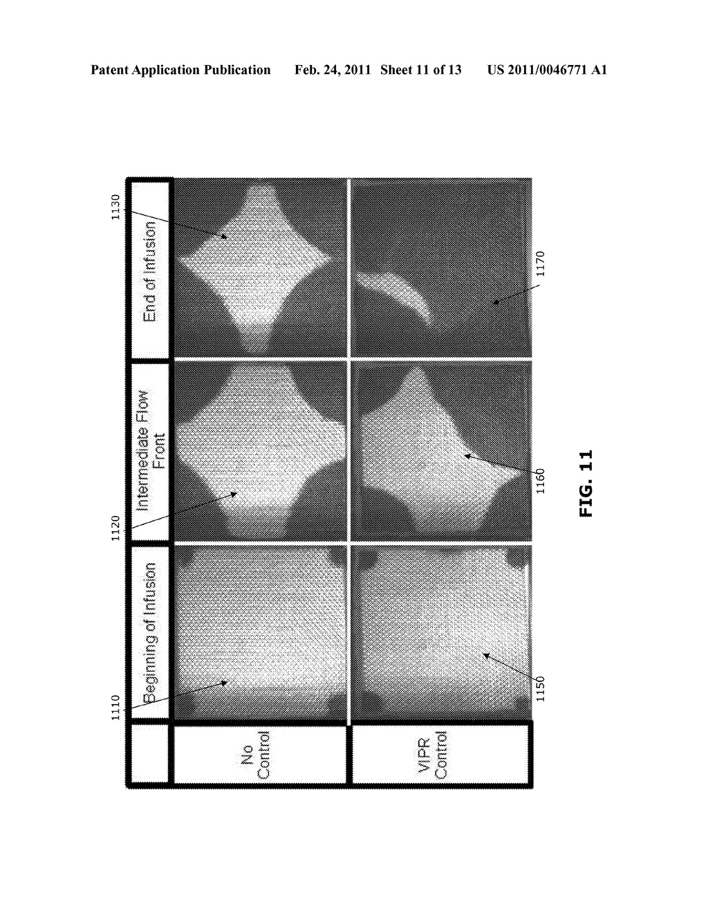 Computer Controlled Flow Manipulation For Vacuum Infusion Processes - diagram, schematic, and image 12