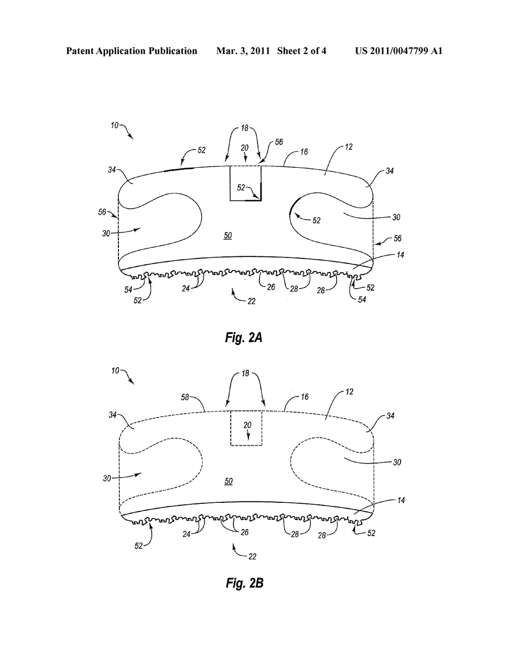 LASER SHAPED GREEN METAL BODY AND ORTHODONTIC BRACKET - diagram, schematic, and image 03