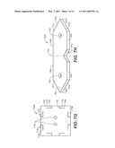 DRY-STACK MASONRY SYSTEM diagram and image