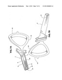 Nostril Inserts diagram and image