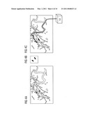 Method for forming an interventional aid with the aid of self-organizing nanorobots consisting of catoms and associated system unit diagram and image