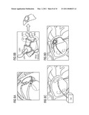 Method for forming an interventional aid with the aid of self-organizing nanorobots consisting of catoms and associated system unit diagram and image