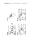 Method for forming an interventional aid with the aid of self-organizing nanorobots consisting of catoms and associated system unit diagram and image