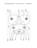 MOULD FOR METAL CASTING AND METHOD USING SAME diagram and image