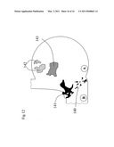 MOULD FOR METAL CASTING AND METHOD USING SAME diagram and image