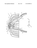 RETAINING DEVICE, ESPECIALLY FOR FLAT ROOF DRAINS diagram and image