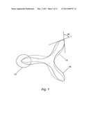 HEART VALVE PROSTHESIS AND METHOD OF MANUFACTURE diagram and image