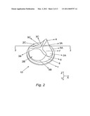 HEART VALVE PROSTHESIS AND METHOD OF MANUFACTURE diagram and image