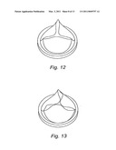 HEART VALVE PROSTHESIS AND METHOD OF MANUFACTURE diagram and image