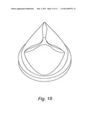 HEART VALVE PROSTHESIS AND METHOD OF MANUFACTURE diagram and image