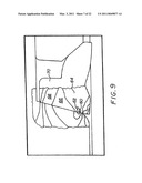 FERRULE WITH RELIEF TO REDUCE GALLING diagram and image